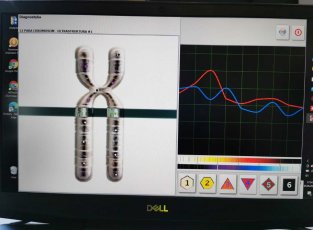 DIAGNOSTYKA BIOREZONANSEM NLS
