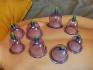 STAWIANIE BANIEK LECZNICZYCH